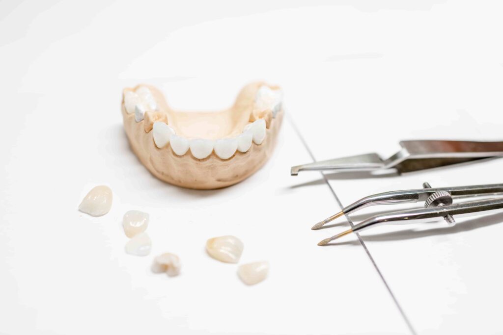 Dental Veneers treatment benefit