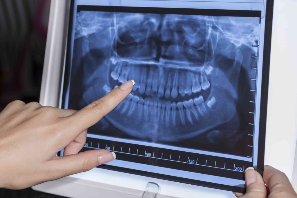 Dental X-rays at Maju s2 Dental in Wangsa Maju