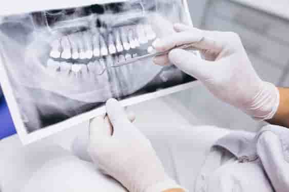 Dental X-rays price in wangsa maju