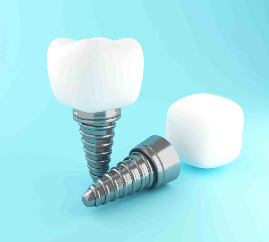 Dental implant process at maju s2 wangsa maju