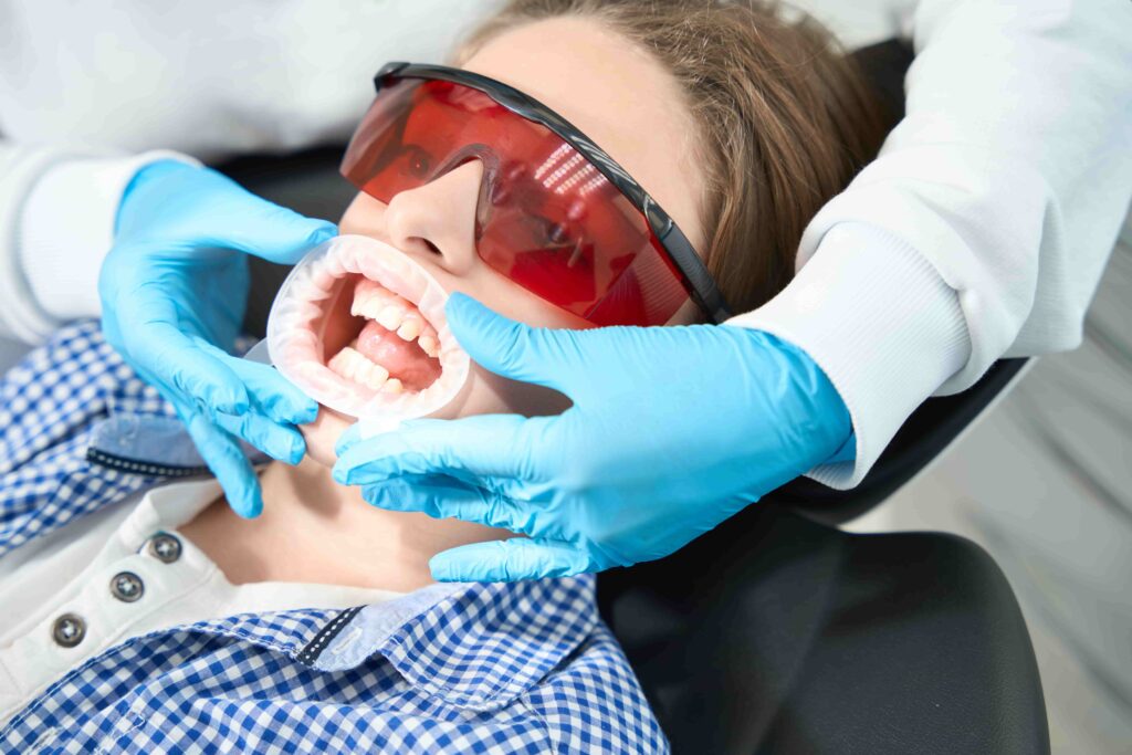 Tooth-Coloured Fillings process