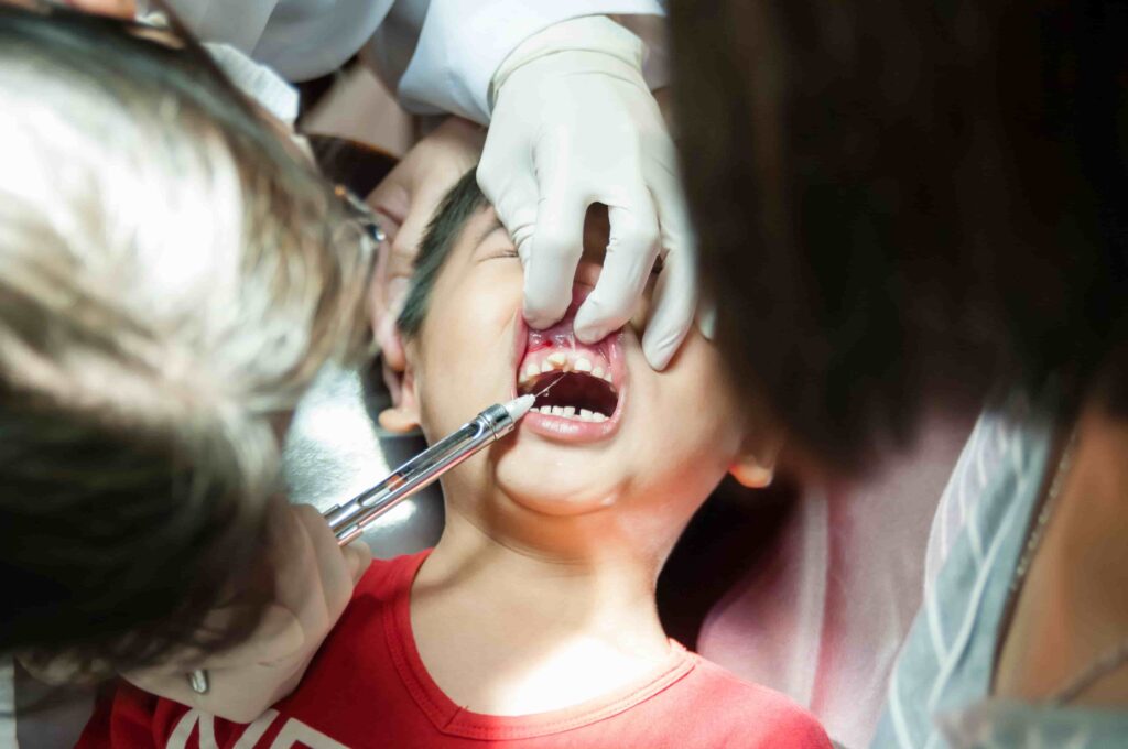 Tooth Extraction Services in Wangsa Maju