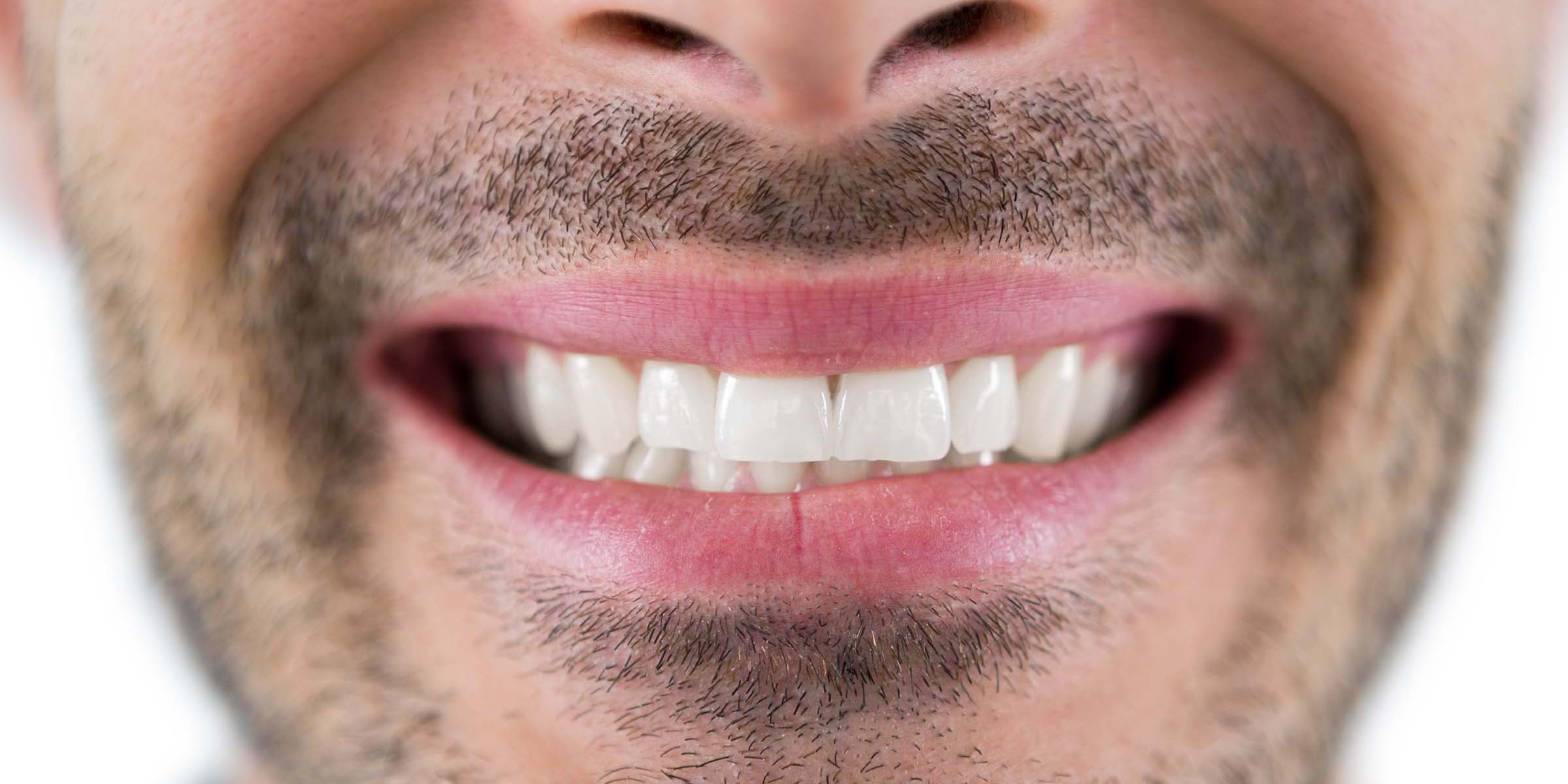 Man showing his teeth after treatment